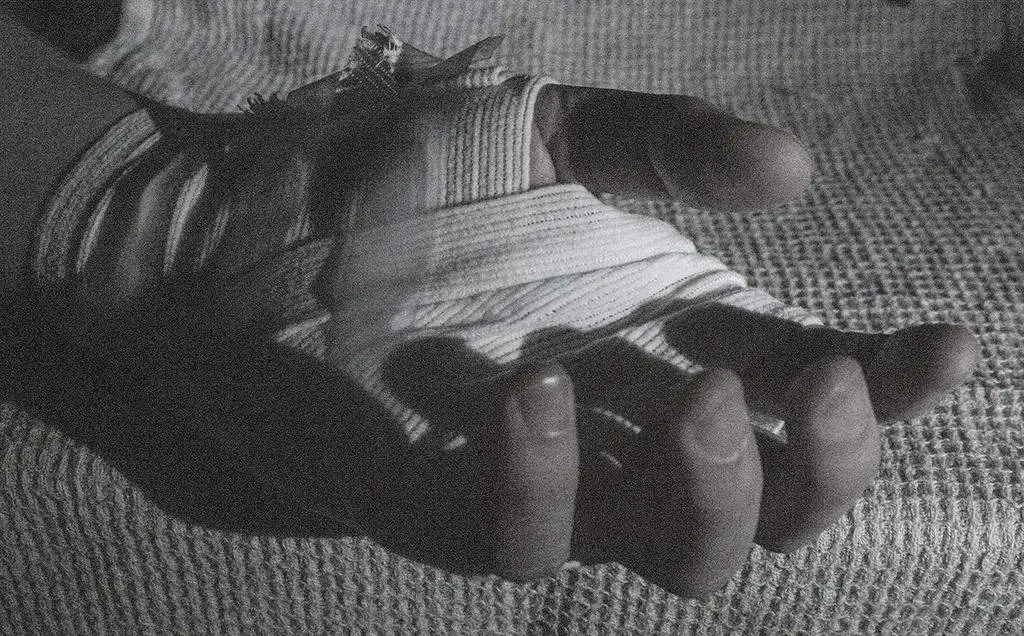 How to Take Grainy Photos! ISO 12800 Moody image of a bandaged hand.